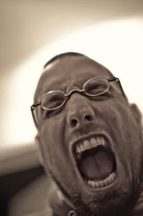 Nódulo Vocal