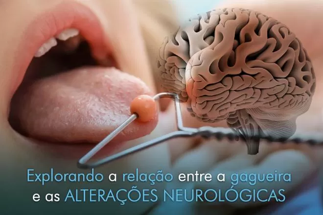 Explorando a relação entre a gagueira e as alterações neurológicas